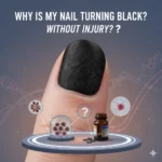Why Is My Nail Turning Black Without Injury?